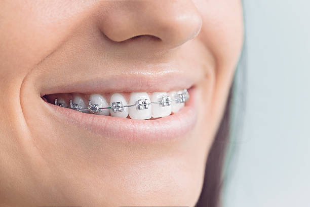 Laser Dentistry in Doffing, TX
